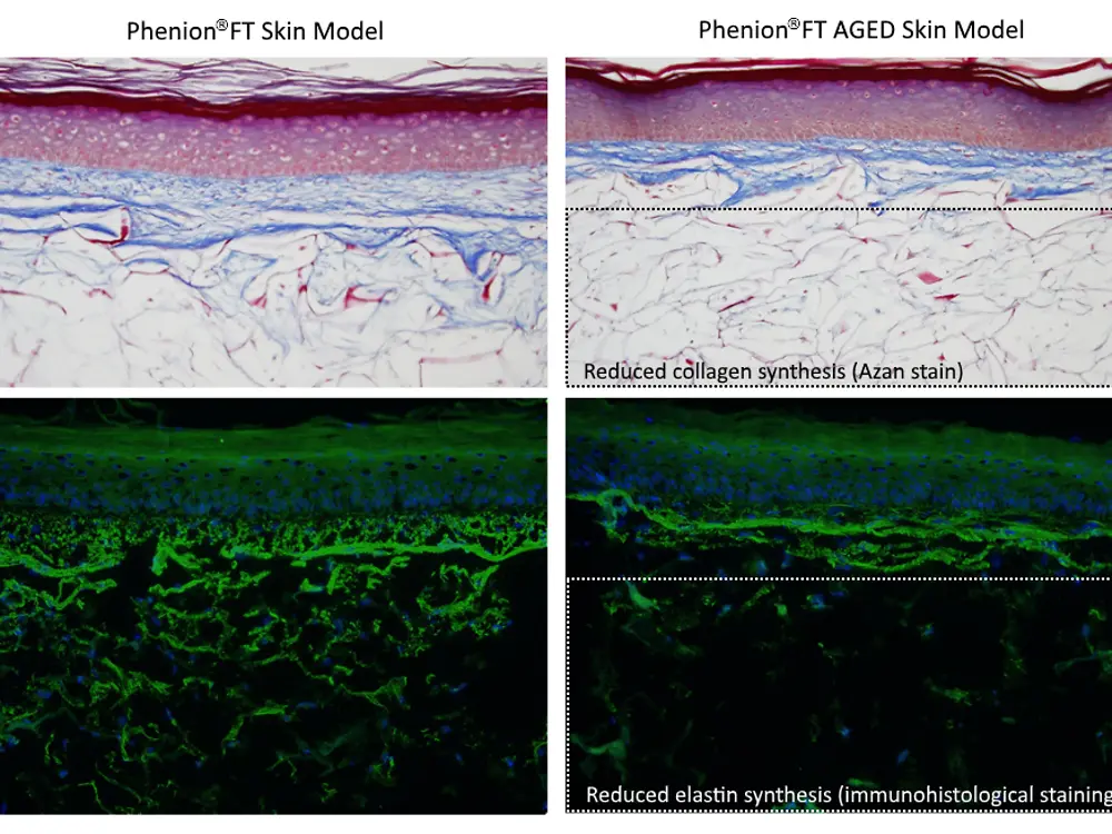 Phenion FT skin model compared to Phenion Aged FT skin model