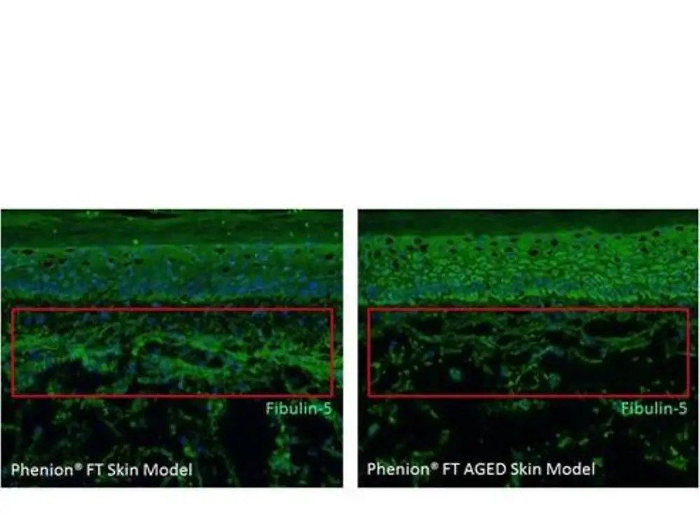 Phenion FT SKin Model Fibulin 5